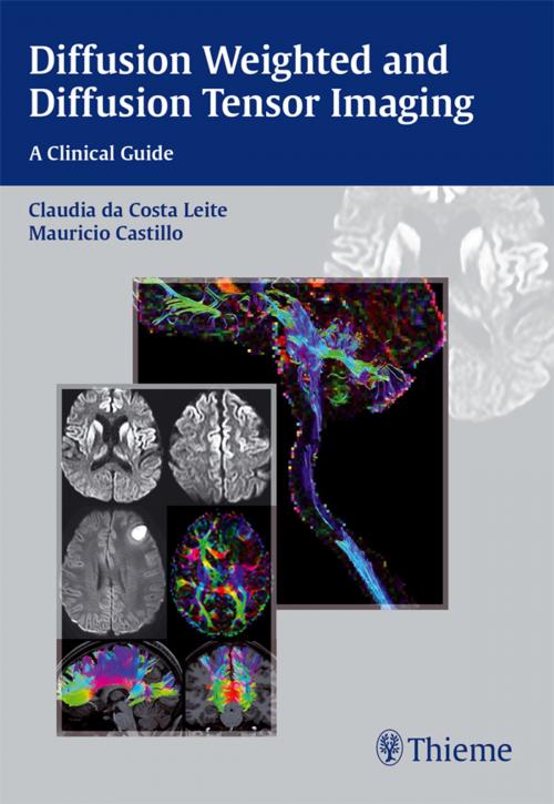 Cover of the book Diffusion Weighted and Diffusion Tensor Imaging: A Clinical Guide by , Thieme