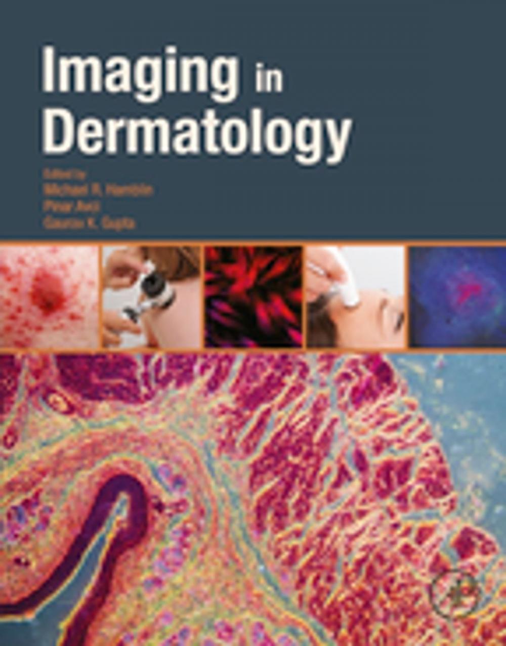 Big bigCover of Imaging in Dermatology