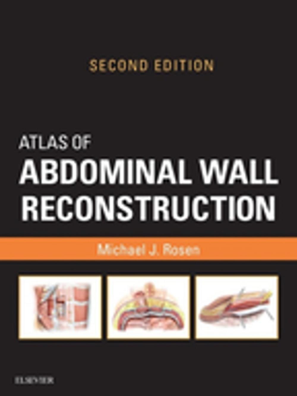 Big bigCover of Atlas of Abdominal Wall Reconstruction E-Book