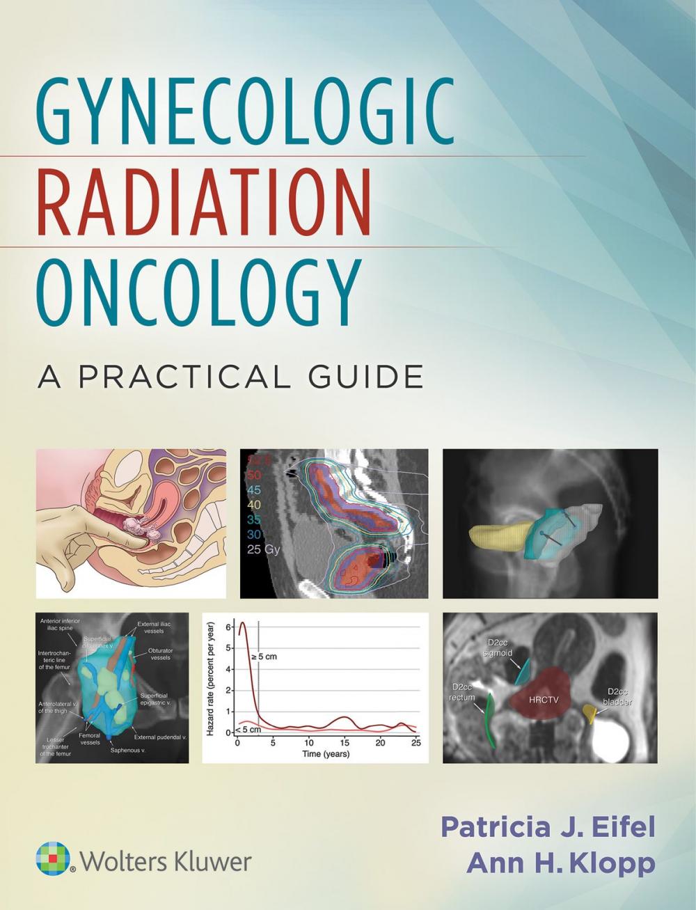 Big bigCover of Gynecologic Radiation Oncology: A Practical Guide