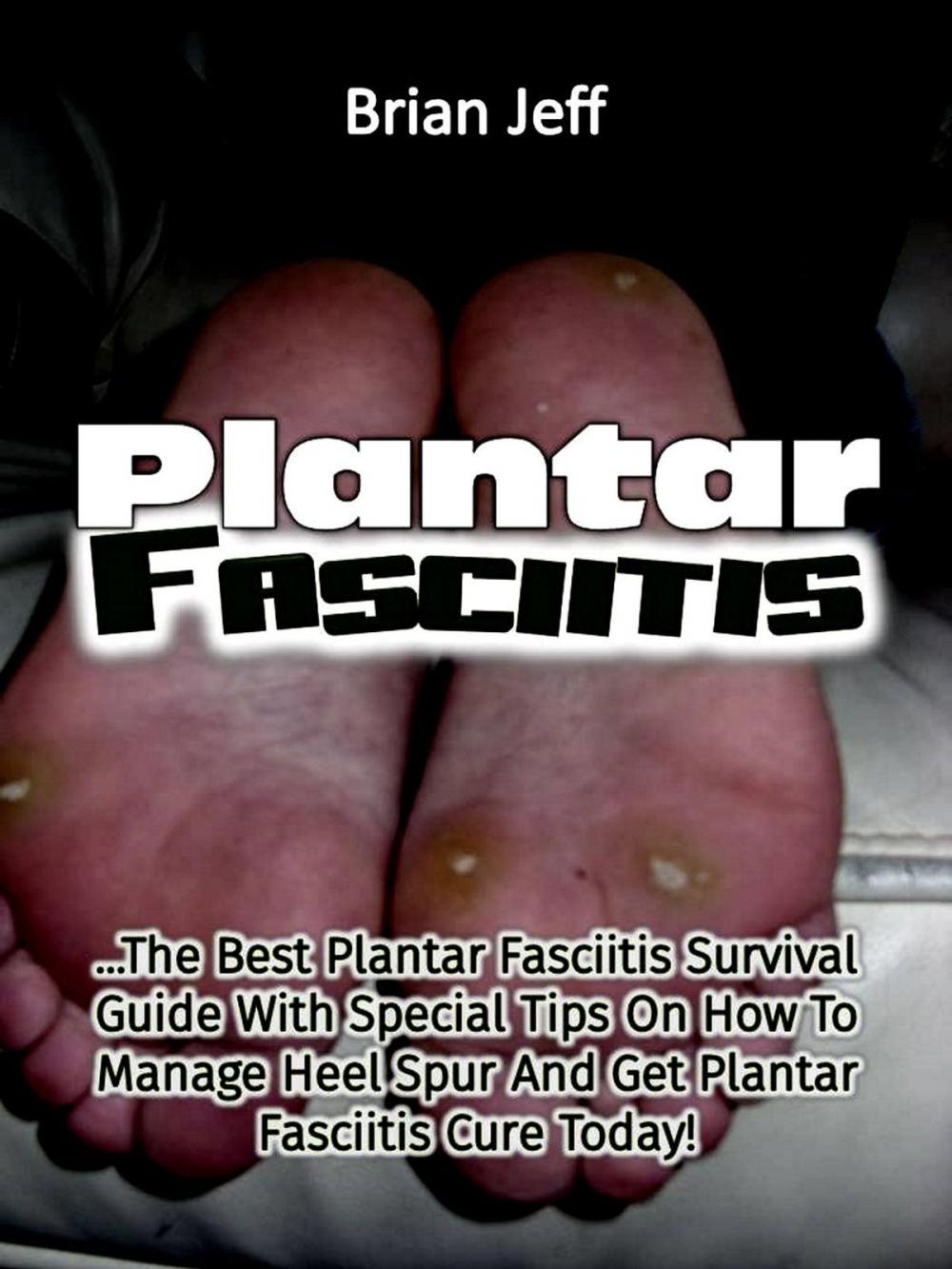 Big bigCover of Plantar Fasciitis: The Best Plantar Fasciitis Survival Guide With Special Tips On How To Manage Heel Spur And Get Plantar Fasciitis Cure Today!