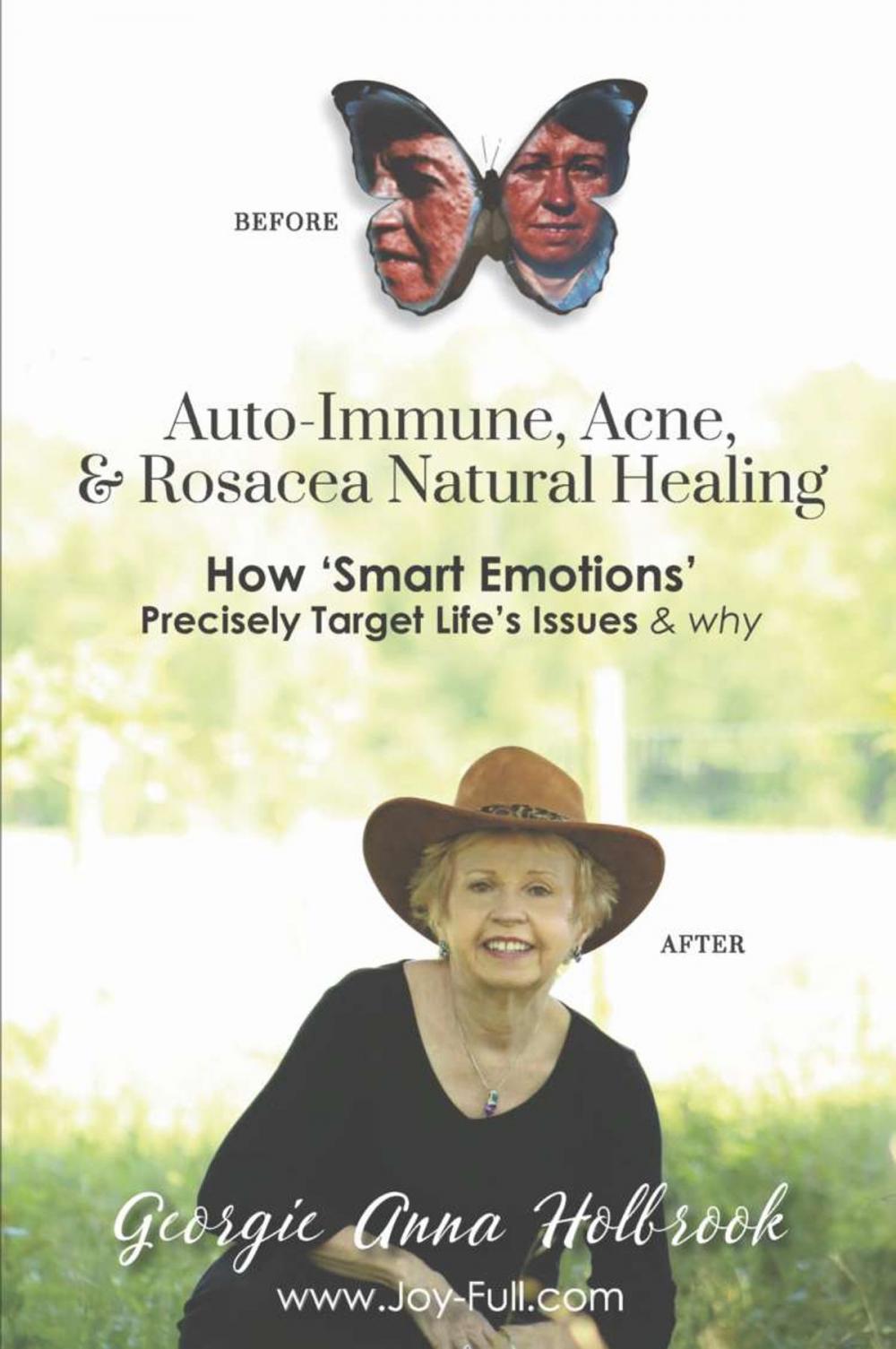 Big bigCover of Auto-Immune, Acne, & Rosacea Natural Healing - How 'Smart Emotions' Precisely Target Life's Issues & Why