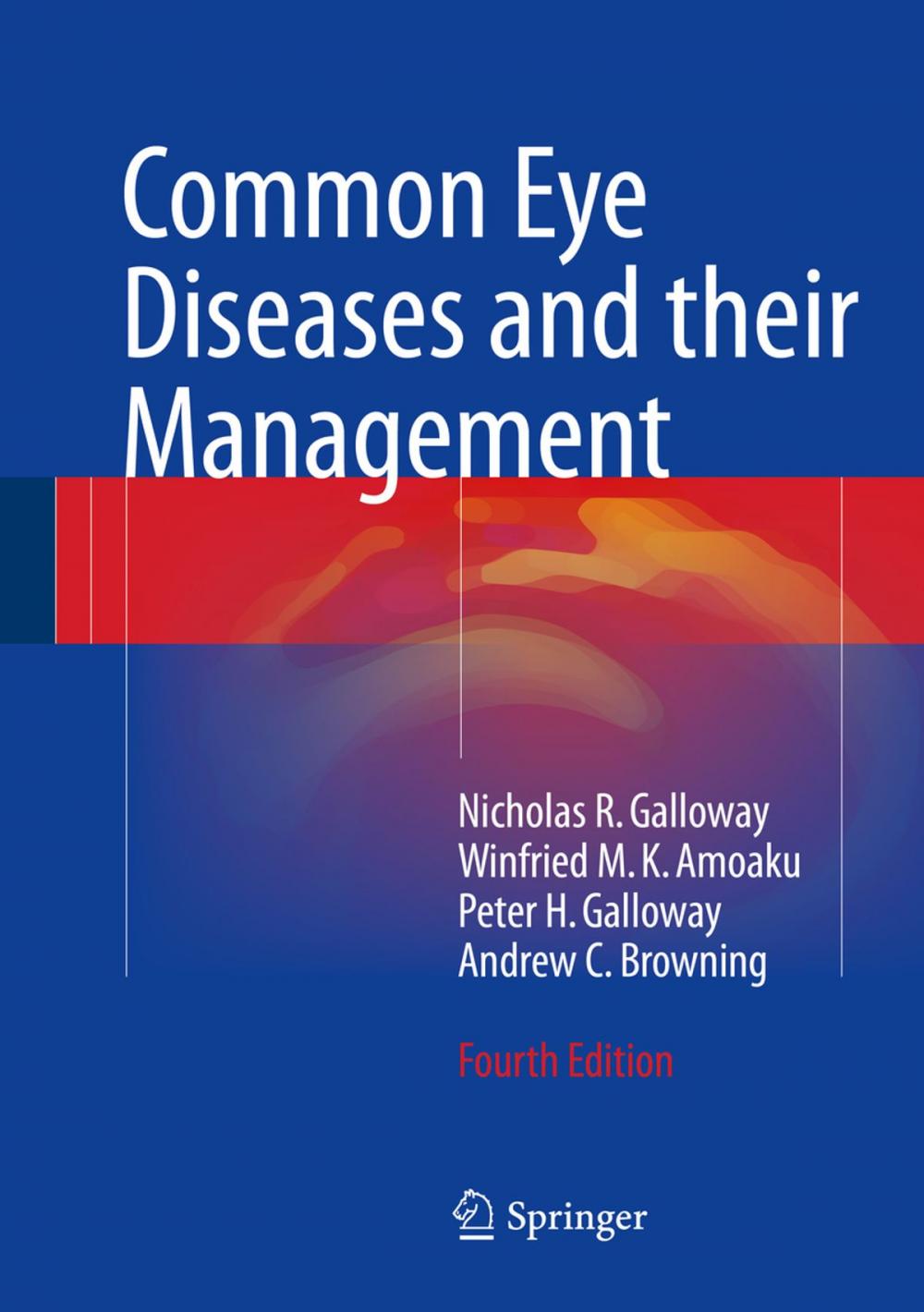 Big bigCover of Common Eye Diseases and their Management