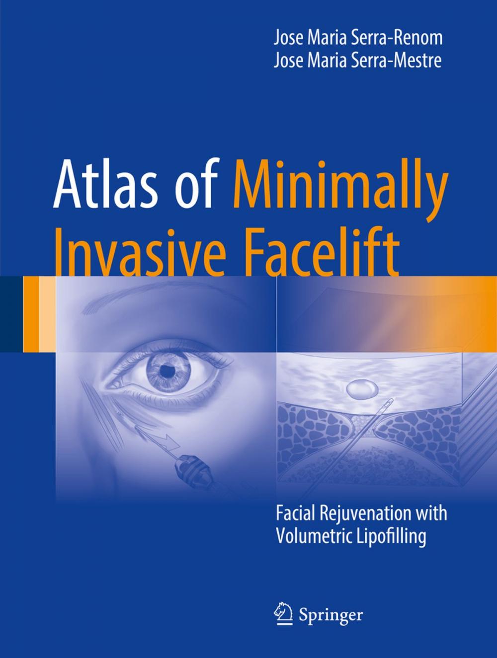 Big bigCover of Atlas of Minimally Invasive Facelift