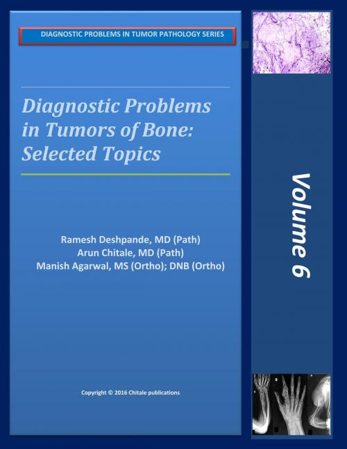 Cover of the book Diagnostic Problems in Tumors Of Bone: Selected Topics by Ramesh Deshpande, Arun Chitale, Manish Agarwal, Dhananjay Chitale