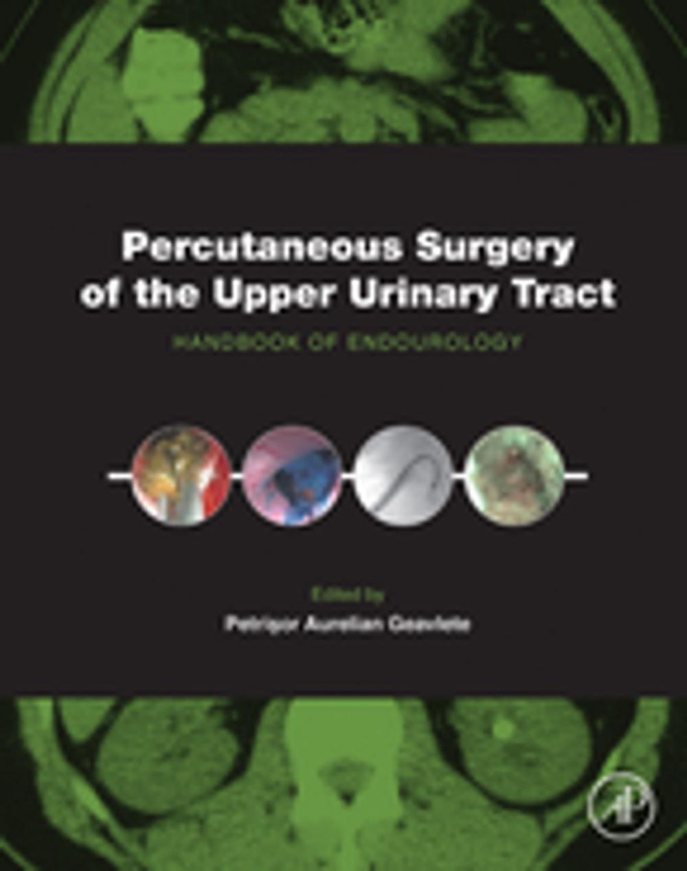 Big bigCover of Percutaneous Surgery of the Upper Urinary Tract