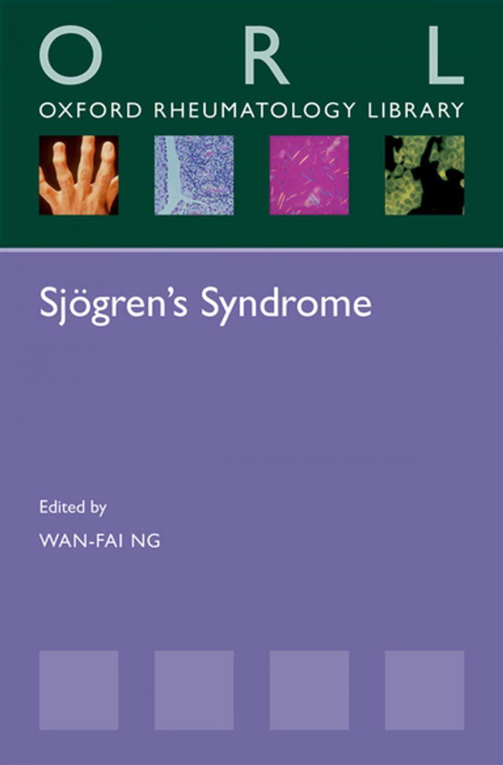 Big bigCover of Sjögren's Syndrome