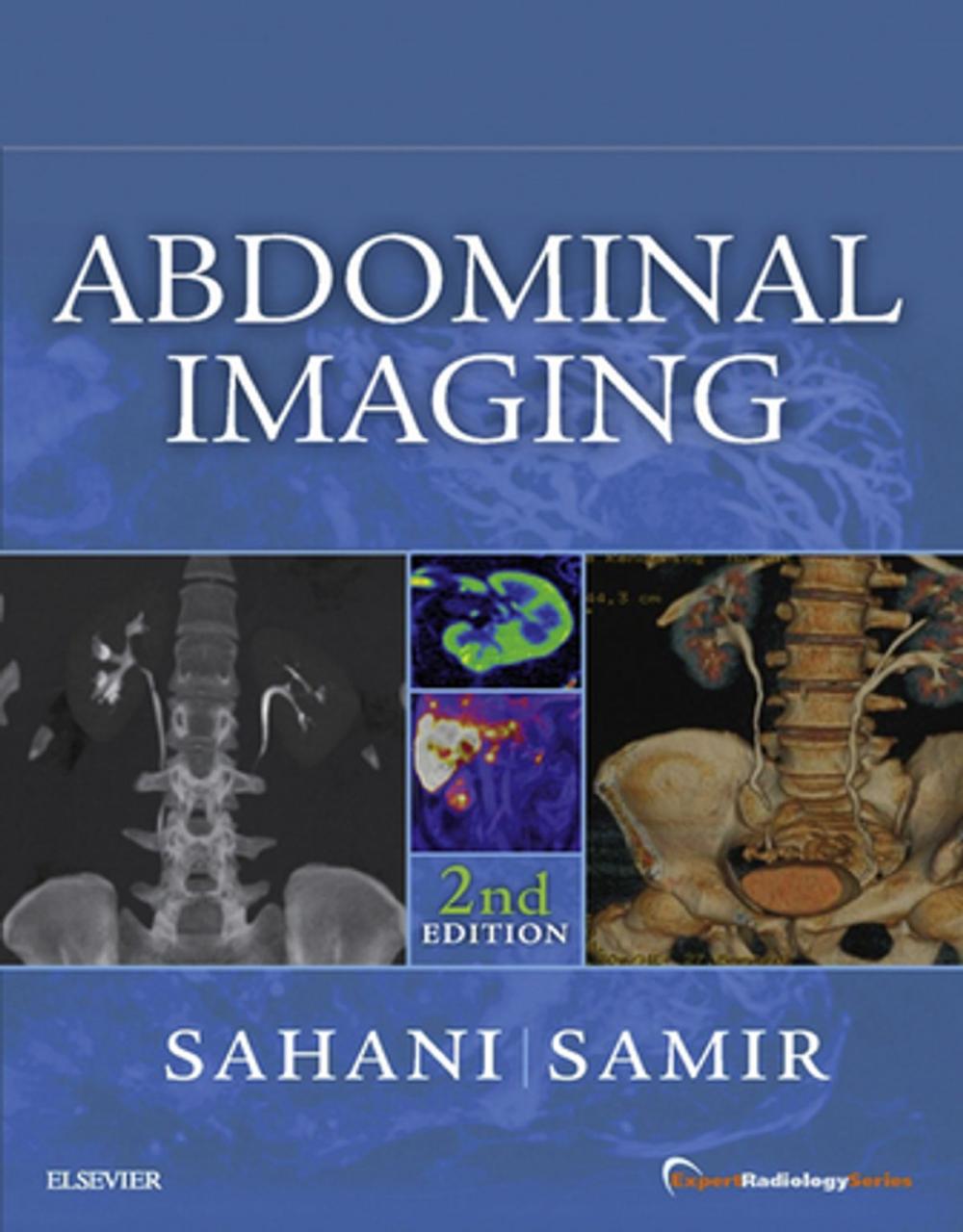 Big bigCover of Abdominal Imaging E-Book