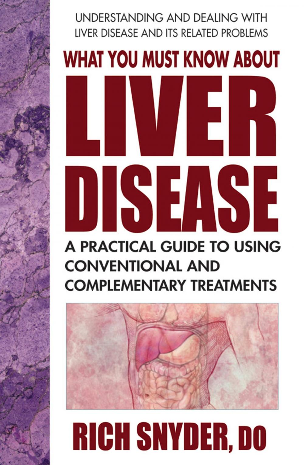 Big bigCover of What You Must Know About Liver Disease