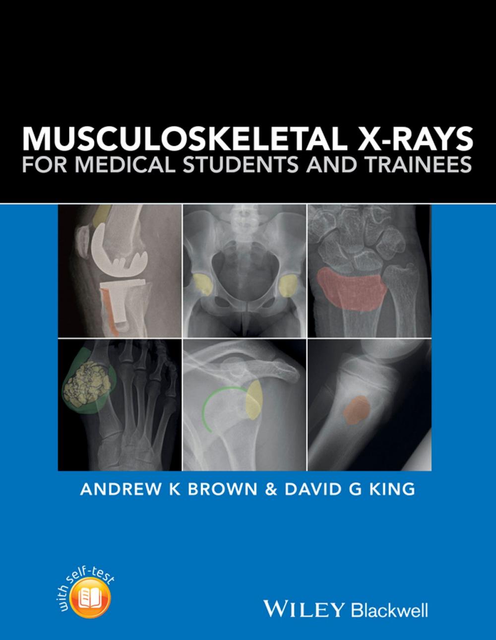 Big bigCover of Musculoskeletal X-Rays for Medical Students and Trainees