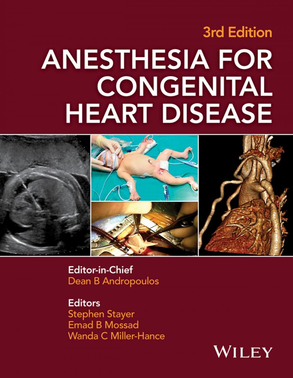 Big bigCover of Anesthesia for Congenital Heart Disease