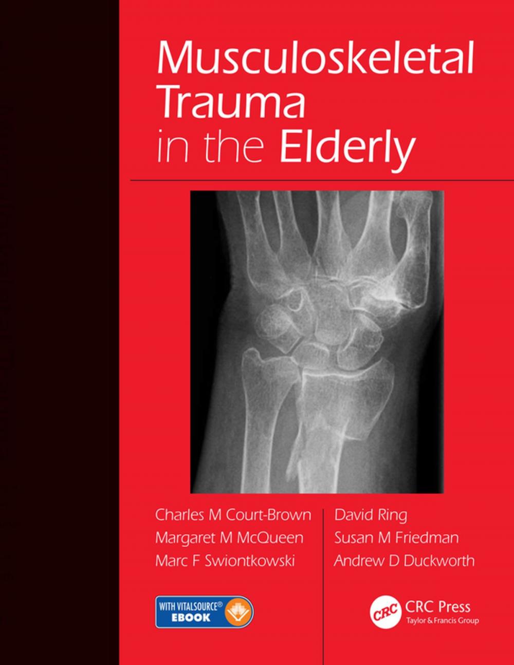 Big bigCover of Musculoskeletal Trauma in the Elderly