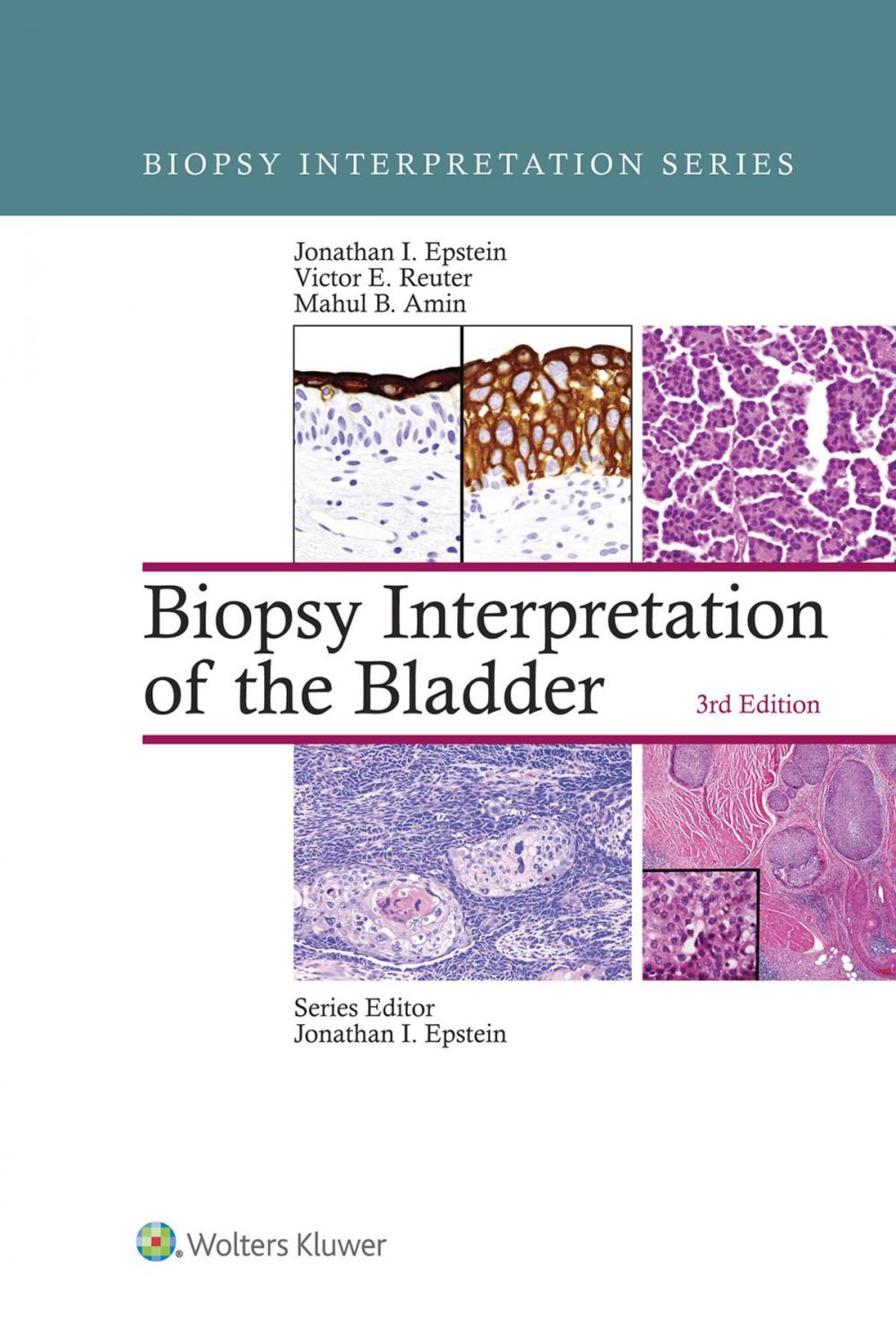 Big bigCover of Biopsy Interpretation of the Bladder