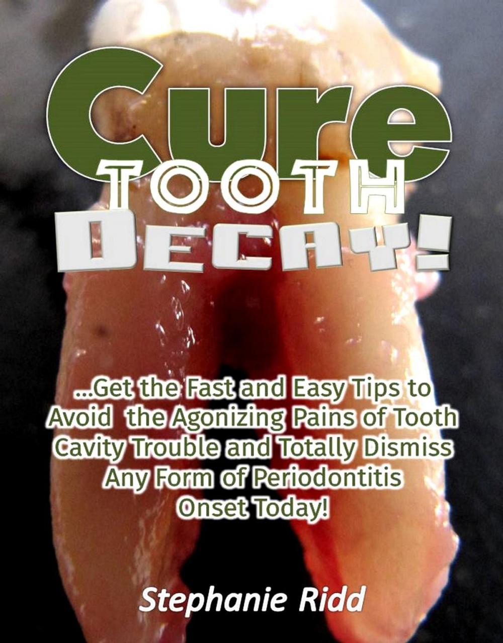 Big bigCover of Cure Tooth Decay! : Get the Fast and Easy Tips to Avoid the Agonizing Pains of Tooth Cavity Trouble and Totally Dismiss Any Form of Periodontitis Onset Today!