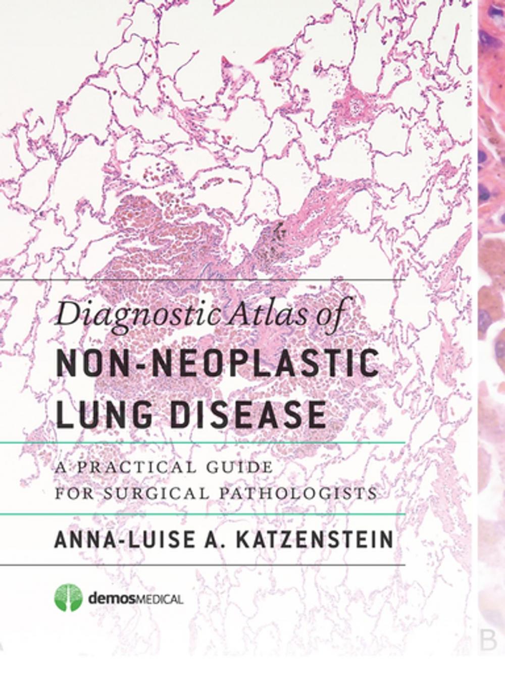 Big bigCover of Diagnostic Atlas of Non-Neoplastic Lung Disease