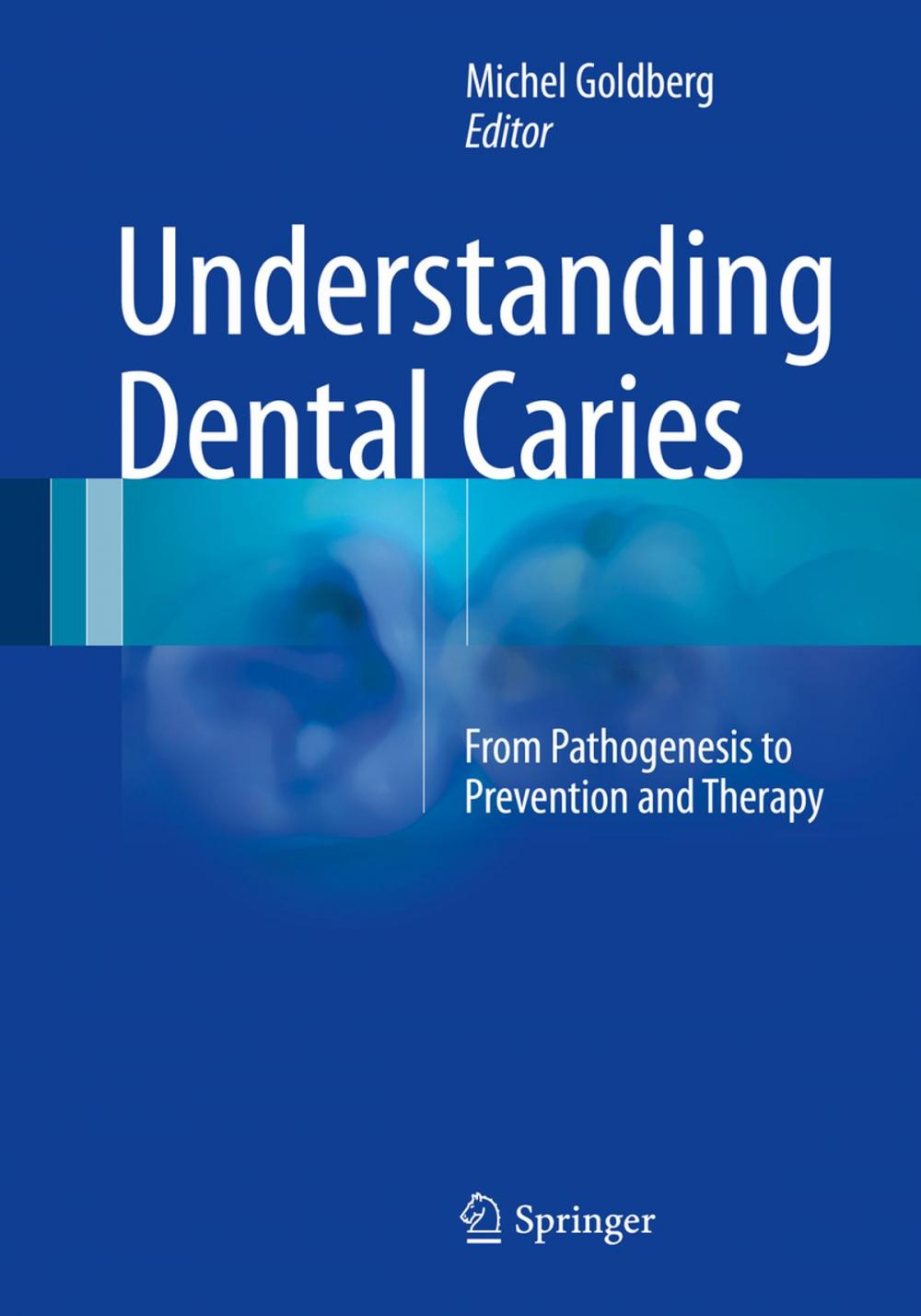 Big bigCover of Understanding Dental Caries