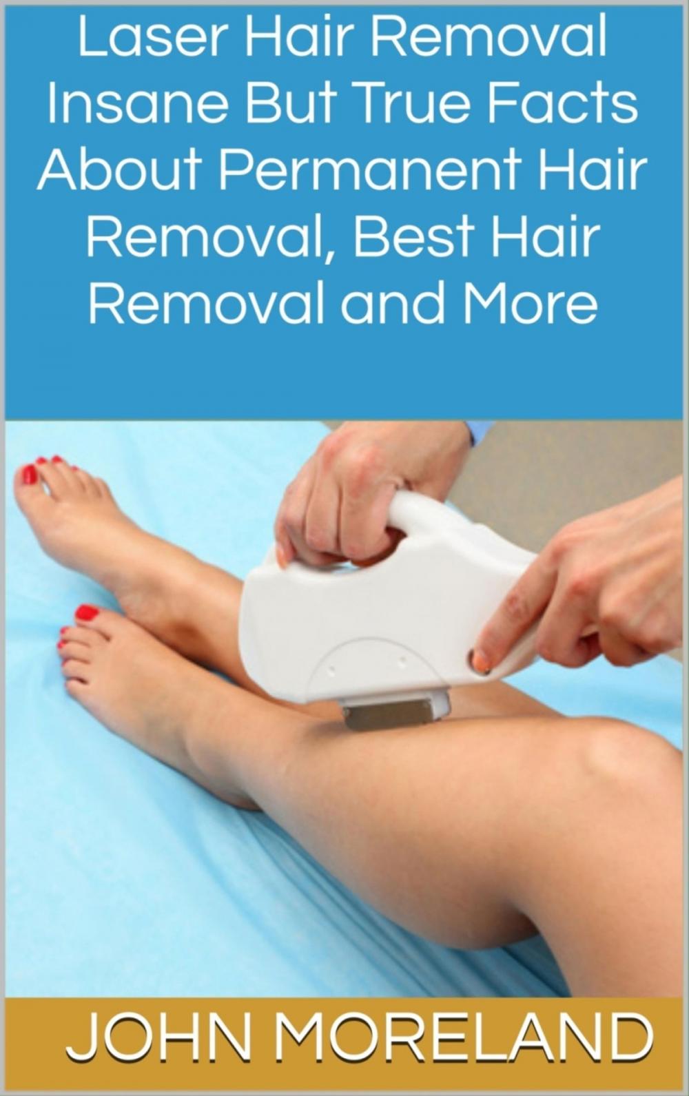 Big bigCover of Laser Hair Removal