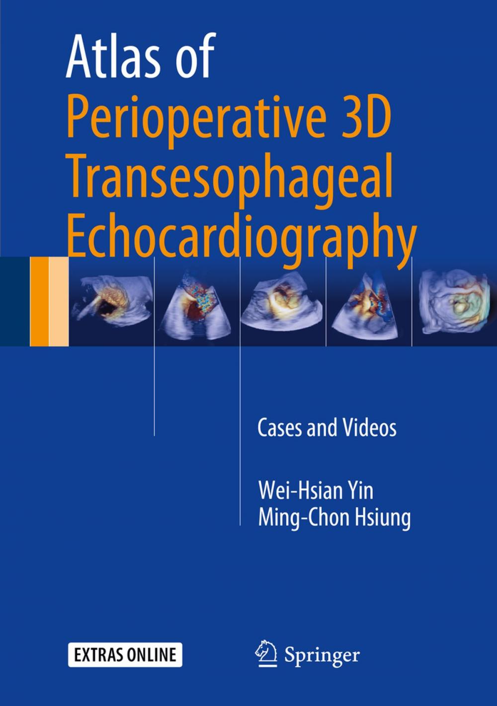 Big bigCover of Atlas of Perioperative 3D Transesophageal Echocardiography