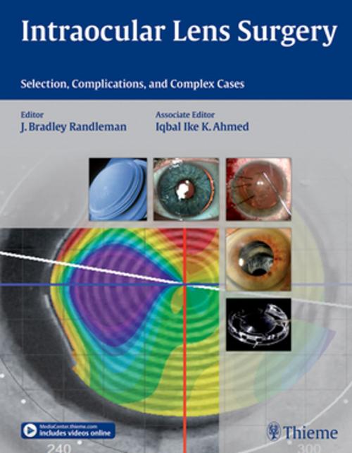 Cover of the book Intraocular Lens Surgery by Bradley Randleman, Iqbal Ike K Ahmed, Thieme
