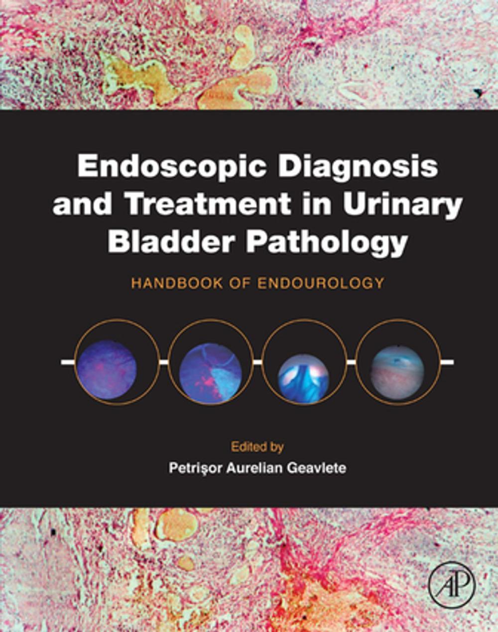 Big bigCover of Endoscopic Diagnosis and Treatment in Urinary Bladder Pathology