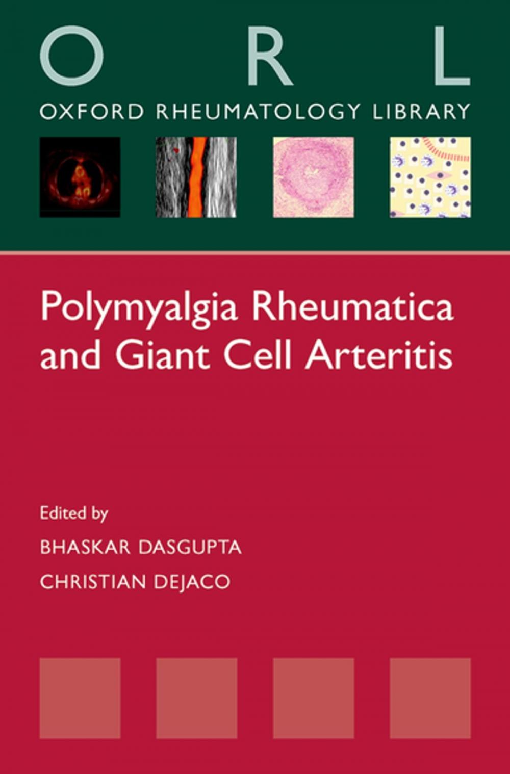 Big bigCover of Polymyalgia Rheumatica and Giant Cell Arteritis