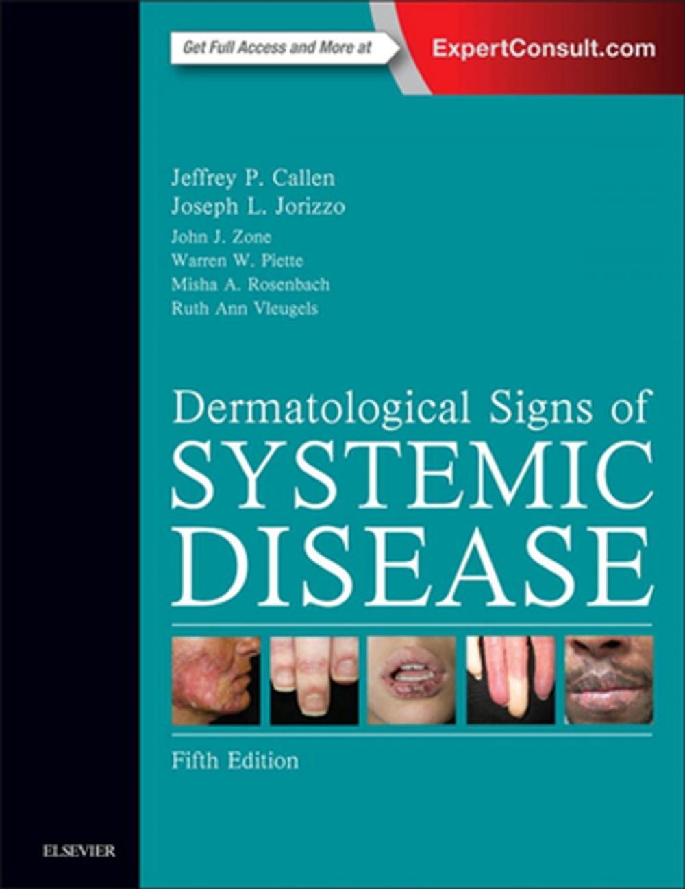 Big bigCover of Dermatological Signs of Systemic Disease E-Book