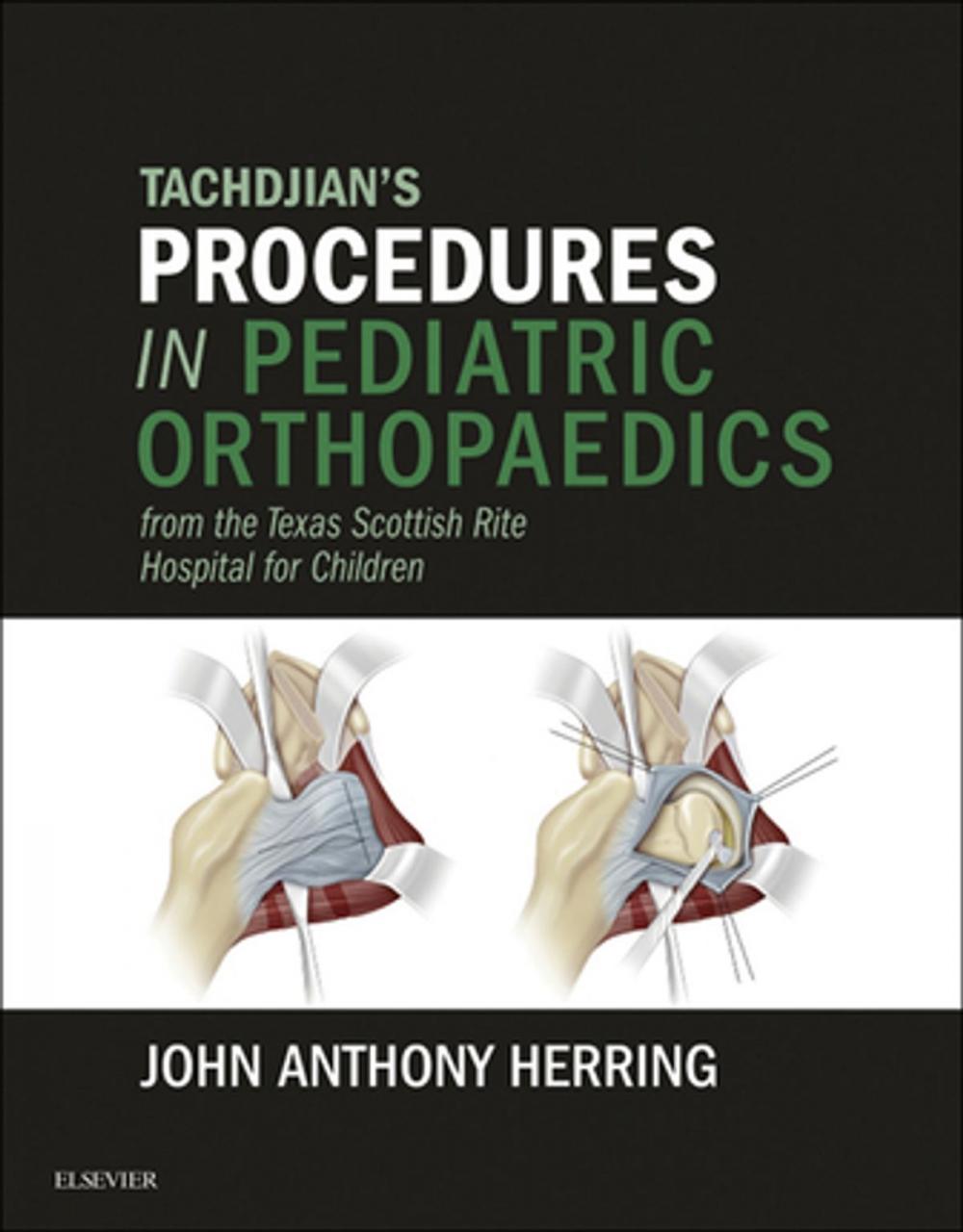 Big bigCover of Tachdjian's Procedures in Pediatric Orthopaedics