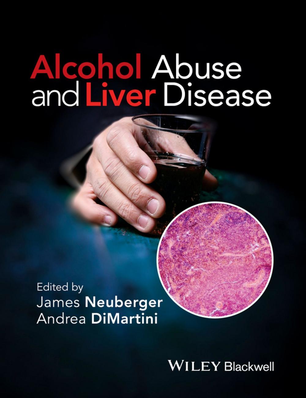 Big bigCover of Alcohol Abuse and Liver Disease