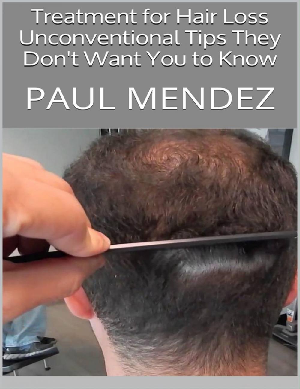 Big bigCover of Treatment for Hair Loss: Unconventional Tips They Don't Want You to Know