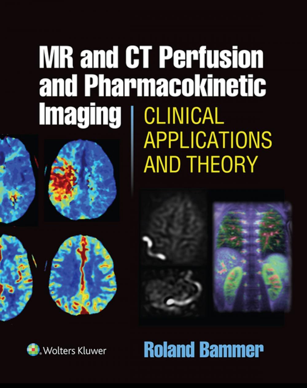 Big bigCover of MR and CT Perfusion and Pharmacokinetic Imaging: Clinical Applications and Theoretical Principles