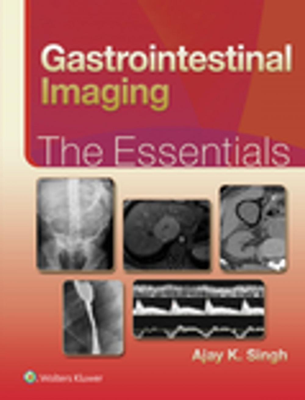 Big bigCover of Gastrointestinal Imaging: The Essentials