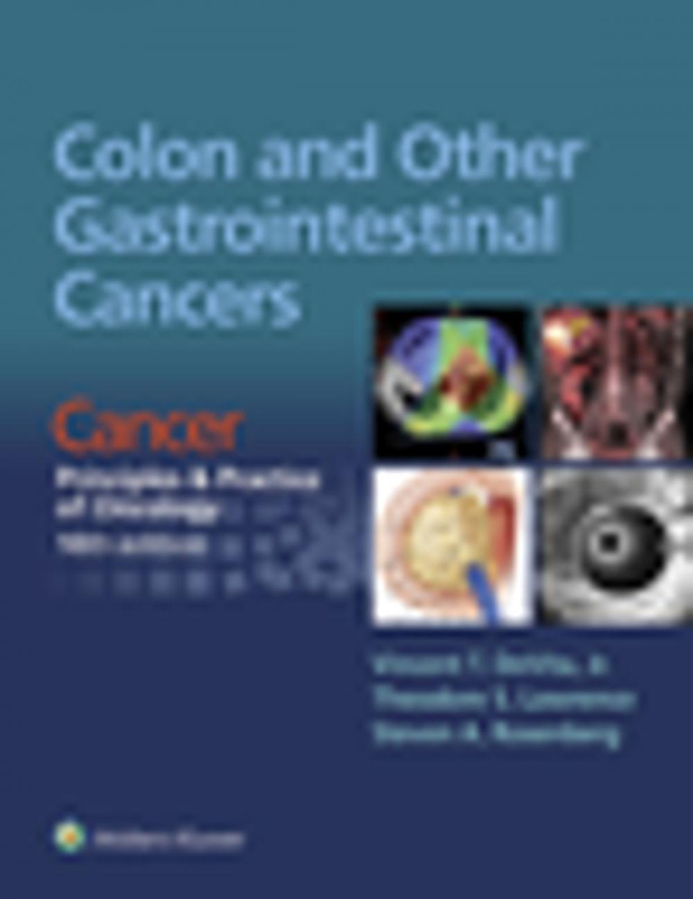 Big bigCover of Colon and Other Gastrointestinal Cancers