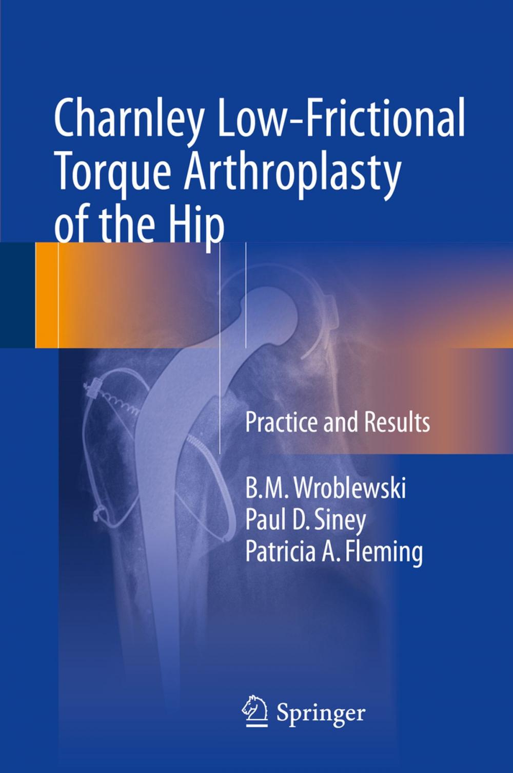 Big bigCover of Charnley Low-Frictional Torque Arthroplasty of the Hip