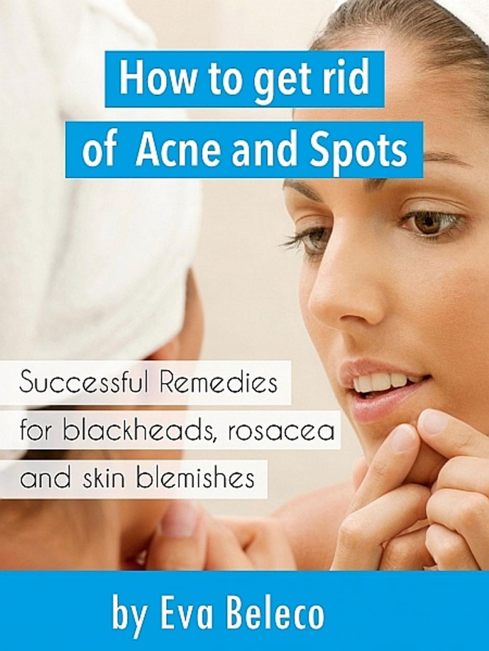 Big bigCover of How to Get Rid of Acne and Spots