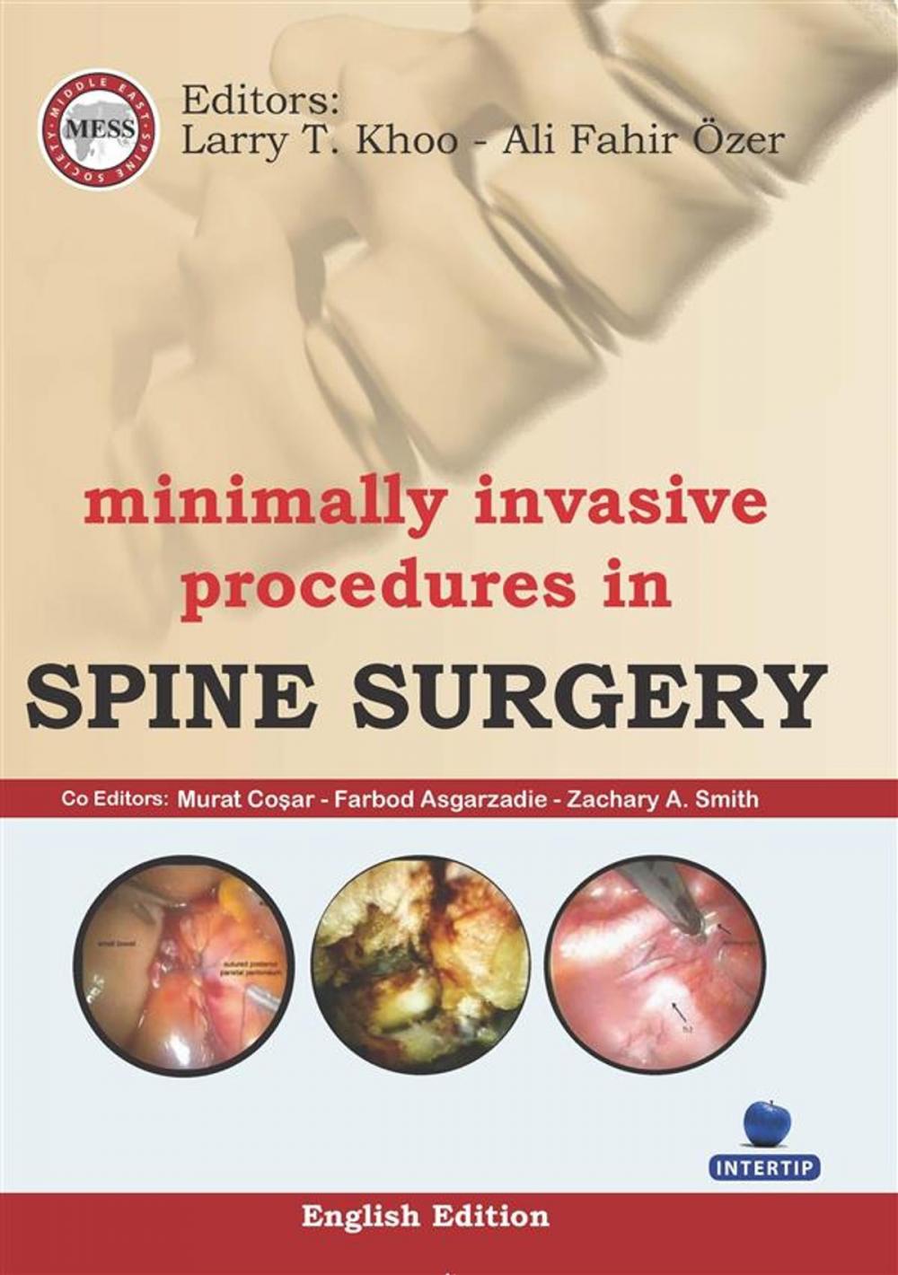 Big bigCover of Minimally Invasive Procedures in Spine Surgery