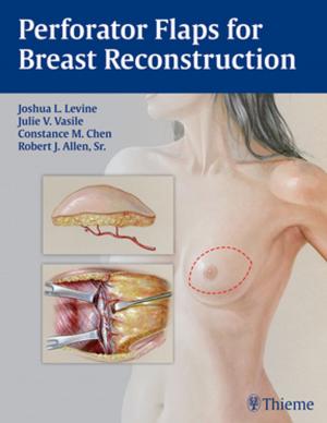 Cover of the book Perforator Flaps for Breast Reconstruction by Carl Philpott, Peter Tassone, Matthew Clark