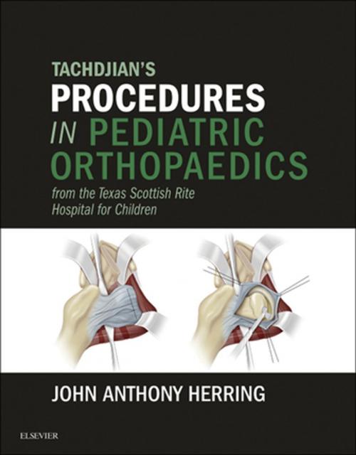 Cover of the book Tachdjian's Procedures in Pediatric Orthopaedics by John A. Herring, MD, Elsevier Health Sciences