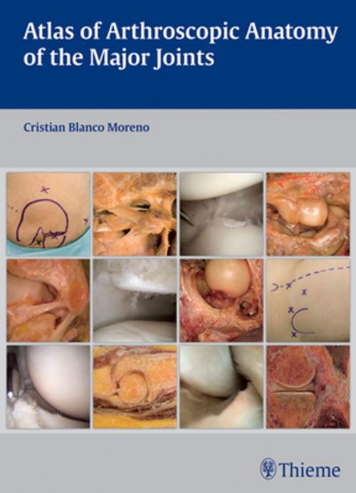 Cover of the book Atlas of Arthroscopic Anatomy of Major Joints by Cristian Blanco Moreno, Thieme