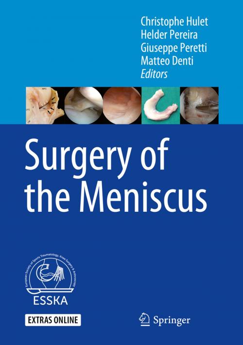 Cover of the book Surgery of the Meniscus by , Springer Berlin Heidelberg