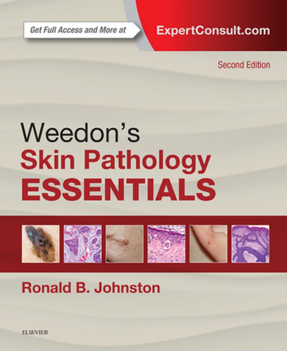 Big bigCover of Weedon's Skin Pathology Essentials E-Book