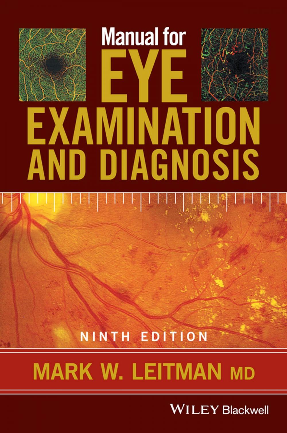 Big bigCover of Manual for Eye Examination and Diagnosis