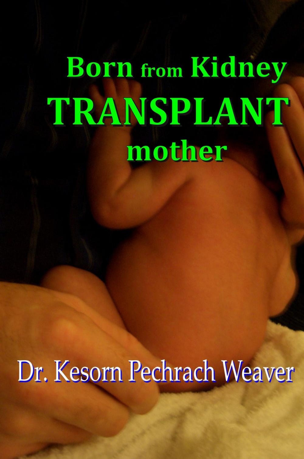 Big bigCover of Born from Kidney Transplant Mother