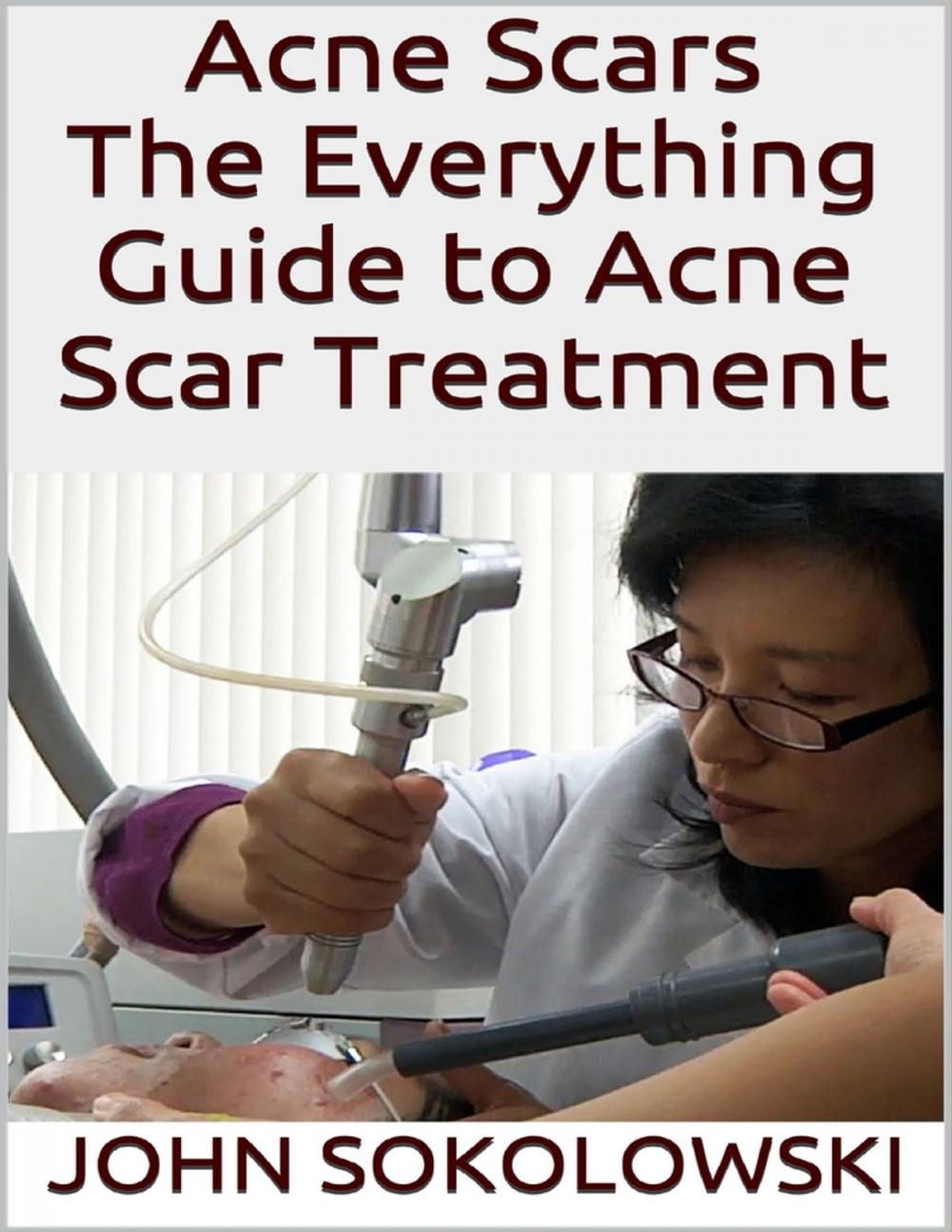 Big bigCover of Acne Scars: The Everything Guide to Acne Scar Treatment