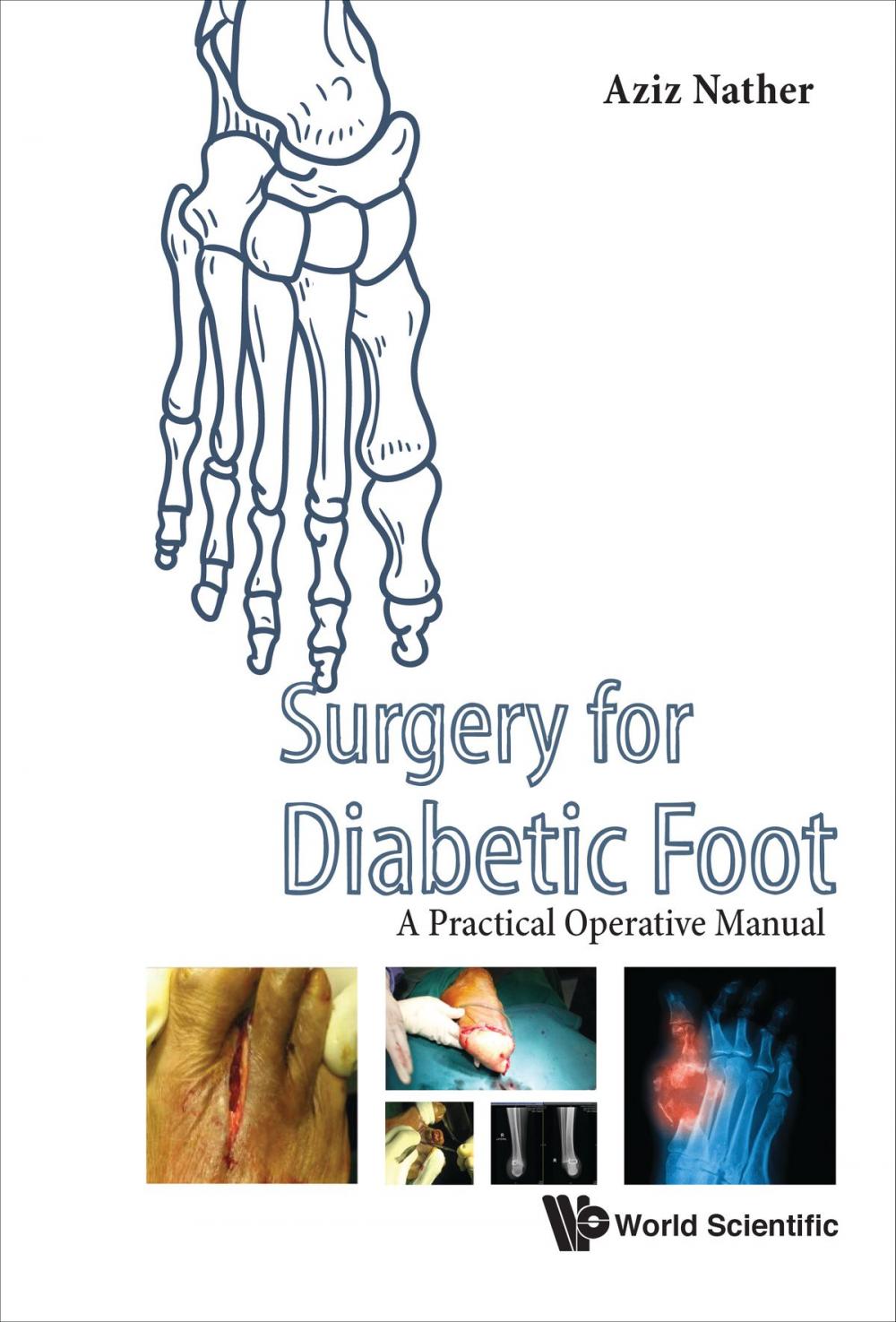 Big bigCover of Surgery for Diabetic Foot