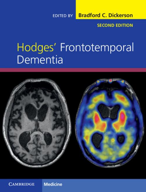 Cover of the book Hodges' Frontotemporal Dementia by , Cambridge University Press