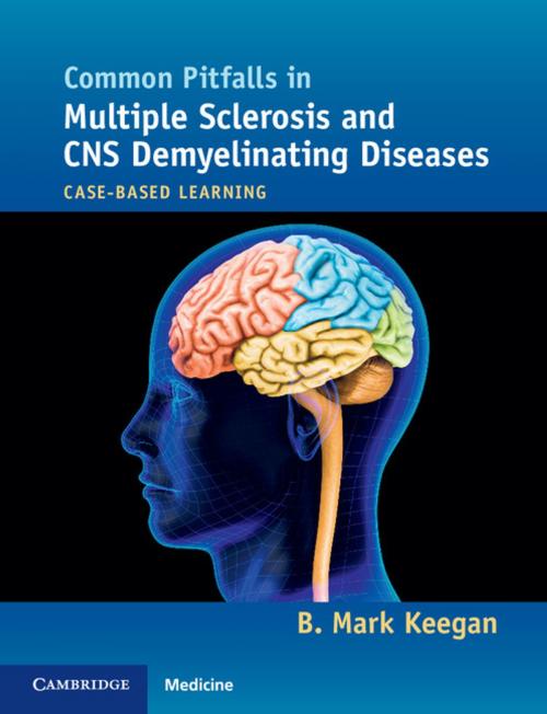 Cover of the book Common Pitfalls in Multiple Sclerosis and CNS Demyelinating Diseases by B. Mark Keegan, Cambridge University Press