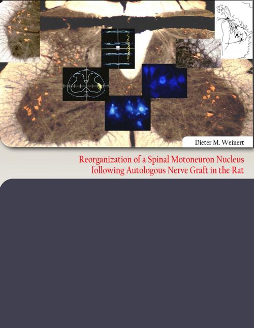 Cover of the book Reorganization of a Spinal Motoneuron Nucleus following Autologous Nerve Graft in the Rat by Dieter M. Weinert, Books on Demand