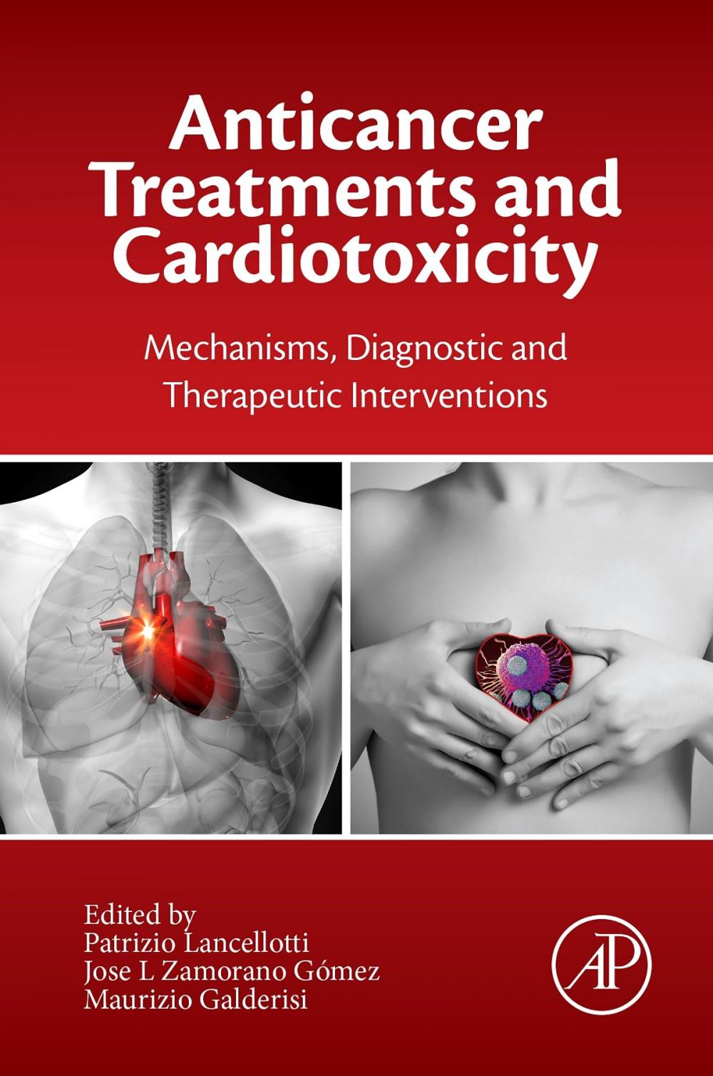 Big bigCover of Anticancer Treatments and Cardiotoxicity