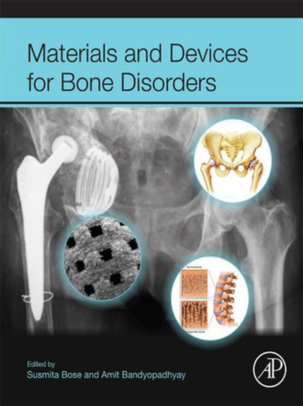 Big bigCover of Materials and Devices for Bone Disorders