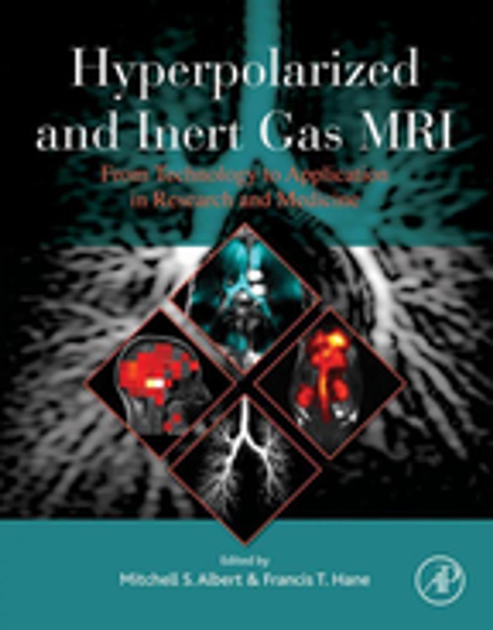 Big bigCover of Hyperpolarized and Inert Gas MRI